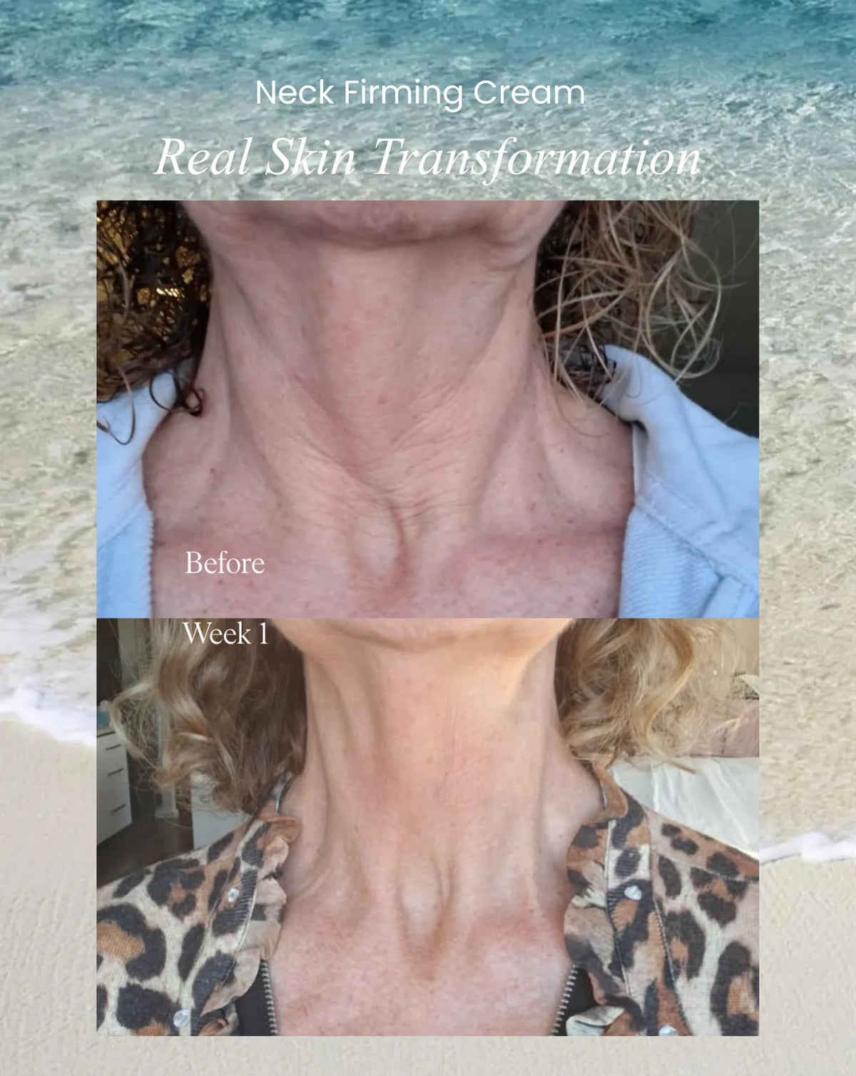 Neck Firming Cream